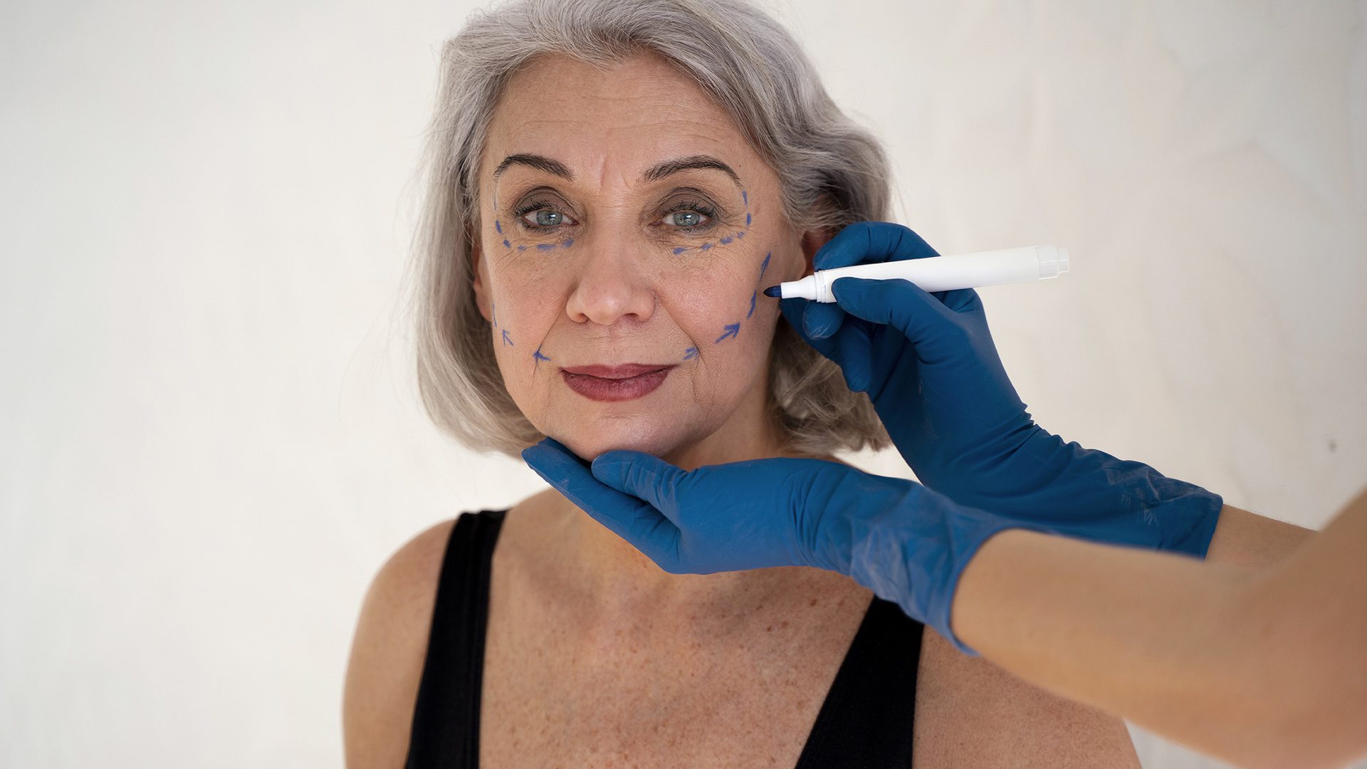 Envejecimiento facial por décadas: criterios clínicos para decidir qué tratar y cuándo