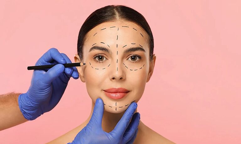 Armonización facial: qué significa este término que se ha vuelto tan popular en redes sociales